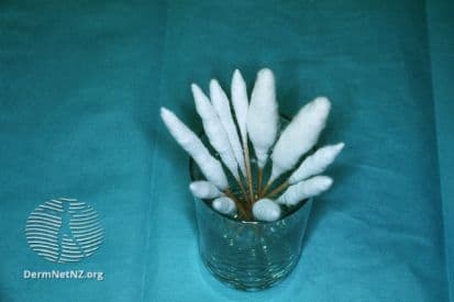 pinnacleskin.com /treatments/cryosurgery Carousel 1 Image 3