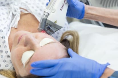 laser-treatment-on-neck