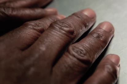 wrinkles-on-hands